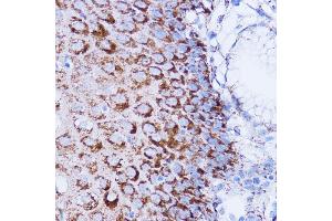 Immunohistochemistry of paraffin-embedded human esophageal using NDUFB7 antibody (ABIN6132403, ABIN6144480, ABIN6144481 and ABIN6217781) at dilution of 1:100 (40x lens).