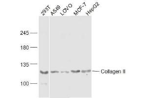Lane 1: 293T lysates Lane 2: A549 lysates Lane 3: LOVO lysates Lane 4: MCF-7 lysatesLane 5: HepG2 lysates probed with COL2A1 Polyclonal Antibody, Unconjugated  at 1:300 dilution and 4˚C overnight incubation. (COL2A1 anticorps  (AA 231-330))