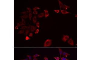 Immunofluorescence analysis of HeLa cells using SKAP2 Polyclonal Antibody (SKAP2 anticorps)