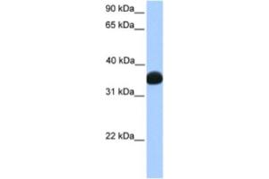 Western Blotting (WB) image for anti-Lactate Dehydrogenase B (LDHB) antibody (ABIN2463156) (LDHB anticorps)
