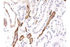 Immunohistochemical staining (Formalin-fixed paraffin-embedded sections) of human kidney transplant.