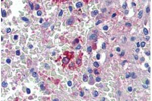 Spleen, Human: Formalin-Fixed, Paraffin-Embedded (FFPE) (HMOX1 anticorps)