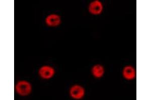 ABIN6274012 staining HepG2 by IF/ICC.