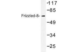Image no. 1 for anti-Frizzled Family Receptor 8 (FZD8) antibody (ABIN317702) (FZD8 anticorps)