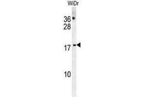 CHCHD2 Antibody (Center) western blot analysis in WiDr cell line lysates (35µg/lane). (CHCHD2 anticorps  (Middle Region))