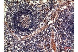 Immunohistochemistry (IHC) analysis of paraffin-embedded Human Lymph Nodes, antibody was diluted at 1:100.