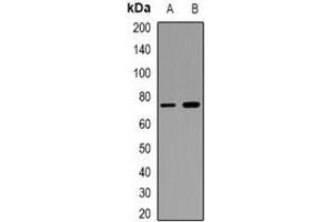 Western blot analysis of CD93 expression in KB (A), THP1 (B) whole cell lysates. (CD93 anticorps)