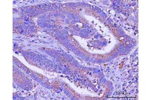 IHC analysis of PTPIP51/RMDN3 using anti-PTPIP51/RMDN3 antibody (ABIN7601775). (RMDN3 anticorps  (AA 45-438))