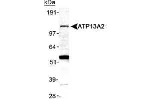 Western blot analysis of ATP13A2 in mouse brain membrane lysate ATP13A2 polyclonal antibody . (ATP13A2 anticorps  (AA 200-300))