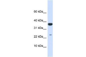 UBE2D2 antibody used at 1 ug/ml to detect target protein. (UBE2D2 anticorps)