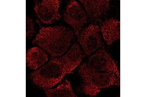 Immunostaining of Hepa1-6 Cells With EEA1 antibody at 1/50 dilution, (EEA1 anticorps  (C-Term))