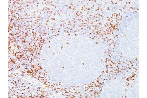 Formalin-fixed, paraffin-embedded human Tonsil stained with CD8 Mouse Monoclonal Antibody (C8/468). (CD8 alpha anticorps)