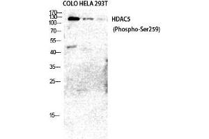 Western Blot (WB) analysis of COLO205 HeLa 293T cells using Phospho-HDAC5/9 (S259/220) Polyclonal Antibody. (HDAC5/9 (pSer220), (pSer259) anticorps)
