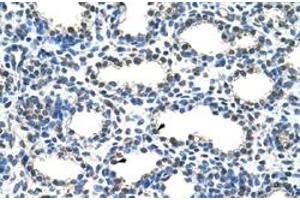 Immunohistochemical staining (Formalin-fixed paraffin-embedded sections) of human lung with ARIH2 polyclonal antibody  at 4-8 ug/mL working concentration. (ARIH2 anticorps  (N-Term))