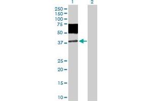 Western Blot analysis of MICA expression in transfected 293T cell line by MICA MaxPab polyclonal antibody. (MICA anticorps  (AA 1-383))