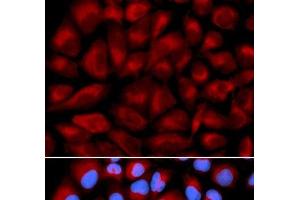 Immunofluorescence analysis of U2OS cells using FANCC Polyclonal Antibody (FANCC anticorps)