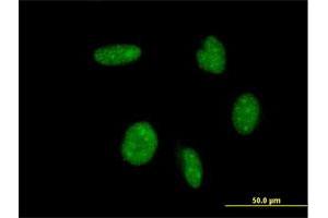 Immunofluorescence of monoclonal antibody to ATOH1 on HeLa cell. (ATOH1 anticorps  (AA 266-354))