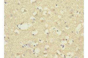 Immunohistochemistry of paraffin-embedded human brain tissue using ABIN7143380 at dilution of 1:100
