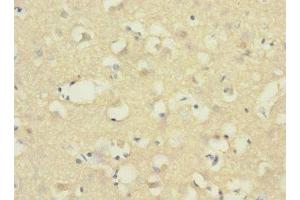Immunohistochemistry of paraffin-embedded human brain tissue using ABIN7143380 at dilution of 1:100 (ADGRB1 anticorps  (AA 60-350))