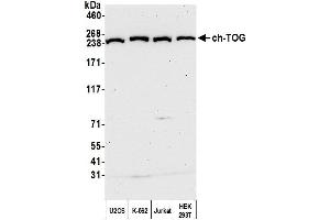 Western Blotting (WB) image for anti-Cytoskeleton Associated Protein 5 (CKAP5) (AA 1982-2032) antibody (ABIN7450111) (CKAP5 anticorps  (AA 1982-2032))