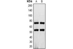 Western blot analysis of CD127 expression in K562 (A), rat heart (B) whole cell lysates. (IL7R anticorps  (C-Term))