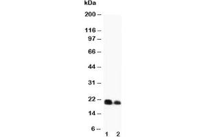 Western blot testing of IL-6 antibody and recombinant protein (1) 10ng, (2) 5ng