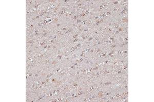 Immunohistochemistry of paraffin-embedded mouse brain using TLK1 antibody (ABIN7270859) at dilution of 1:100 (40x lens).