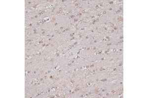 Immunohistochemistry of paraffin-embedded mouse brain using TLK1 antibody (ABIN7270859) at dilution of 1:100 (40x lens). (TLK1 anticorps  (AA 160-230))