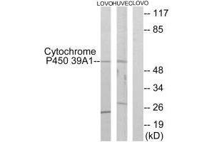 Western blot analysis of extracts from LOVO cells and HUVEC cells, using Cytochrome P450 39A1 antibody. (CYP39A1 anticorps)