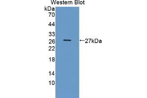 Detection of Recombinant DDC, Human using Polyclonal Antibody to Dopa Decarboxylase (DDC) (DDC anticorps  (AA 200-420))