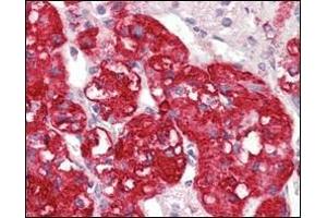 Immunohistochemical analysis of paraffin-embedded human adrenal tissues using STYK1/NOK antibody with DAB staining. (STYK1 anticorps)