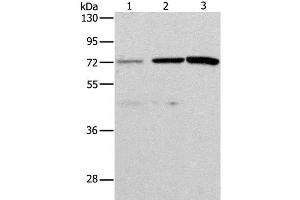 Western Blot analysis of Hela and SKOV3 cell, Mouse liver tissue using ALS2CR11 Polyclonal Antibody at dilution of 1:500 (ALS2CR11 anticorps)