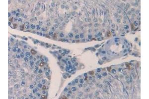Detection of IL18 in Rat Testis Tissue using Polyclonal Antibody to Interleukin 18 (IL18)