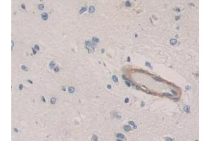 Detection of CDH16 in Human Cerebrum Tissue using Polyclonal Antibody to Cadherin 16 (CDH16)