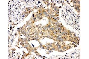 IHC-P: Prolactin Receptor antibody testing of human breast cancer tissue