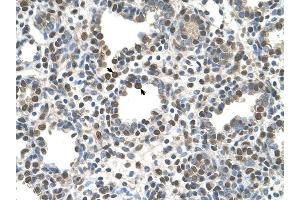 ZDHHC13 antibody was used for immunohistochemistry at a concentration of 4-8 ug/ml to stain Alveolar cells (arrows) in Human Lung. (ZDHHC13 anticorps  (N-Term))