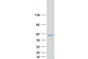 Validation with Western Blot