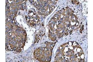 IHC analysis of TMPRSS13 using anti-TMPRSS13 antibody (ABIN7599797). (TMPRSS13 anticorps  (AA 118-572))