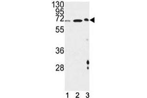 ATF6B anticorps  (AA 560-589)