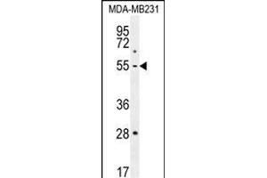 P1 Antibody (Center) (ABIN655817 and ABIN2845241) western blot analysis in MDA-M cell line lysates (35 μg/lane). (MMP1 anticorps  (AA 317-347))