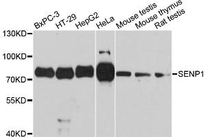 Western blot analysis of extracts of various cell lines, using SENP1 antibody. (SENP1 anticorps)