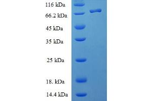 SDS-PAGE (SDS) image for BCL2-Associated Athanogene 5 (BAG5) (AA 1-447), (full length) protein (His-SUMO Tag) (ABIN5711945)