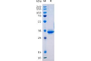 Transmembrane 4 L Six Family Member 1 (TM4SF1) protein (Fc Tag)