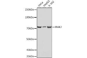 Western blot analysis of extracts of various cell lines, using IR Rabbit mAb (ABIN7268009) at 1:1000 dilution. (IRAK2 anticorps)