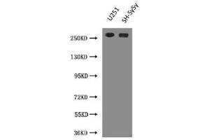 Western Blot Positive WB detected in: U251 whole cell lysate, SH-SY5Y whole cell lysate All lanes: NES antibody at 3 μg/mL Secondary Goat polyclonal to Mouse IgG at 1/10000 dilution Predicted band size: 178 kDa Observed band size: 260 kDa (Nestin anticorps)