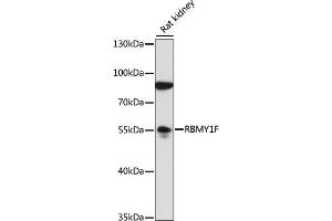 Western blot analysis of extracts of rat kidney, using RBMY1F antibody (ABIN7270095) at 1:1000 dilution.
