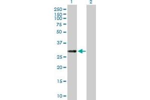 Western Blot analysis of C12orf46 expression in transfected 293T cell line by C12orf46 MaxPab polyclonal antibody. (ERP27 anticorps  (AA 1-273))