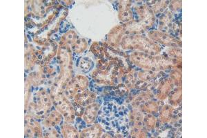 IHC-P analysis of kidney tissue, with DAB staining. (Osteocalcin anticorps  (AA 11-98))
