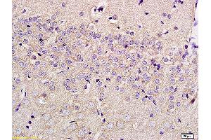 Formalin-fixed and paraffin embedded rat brain labeled with Anti-SLC29A4 Polyclonal Antibody, Unconjugated (ABIN754948) at 1:200 followed by conjugation to the secondary antibody and DAB staining (SLC29A4 anticorps  (AA 401-500))