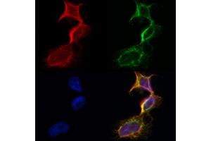 ABIN6260856 and ABIN6273101 staining Hela by IF/ICC.